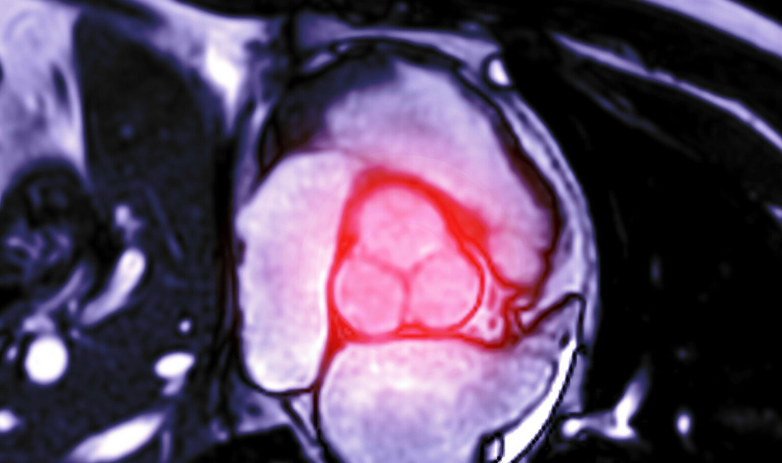 evaluating-echocardiographic-examination-in-history-of-aortic-stenosis